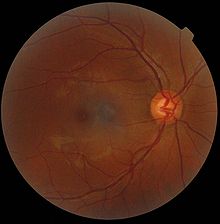 macula